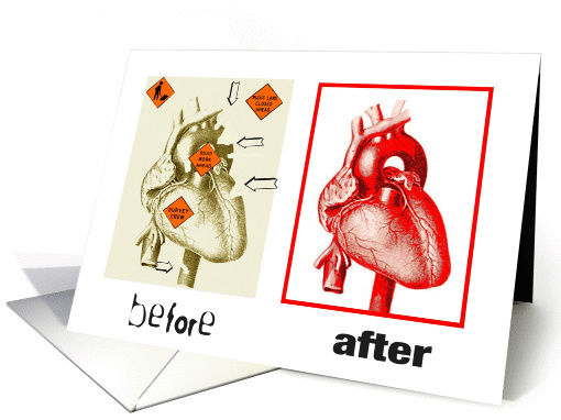 Heart Surgery - Encouragement card (403823)