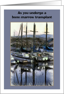 As you undergo a bone marrow transplant, with boats card