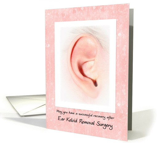Ear Keloid Removal Surgery Recovery With Ear Photograph card (1265936)