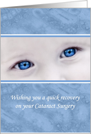 Wishing You A Quick Recovery On Your Cataract Surgery Blue Eyes card