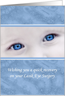 Wishing You A Quick Recovery On Your Lasik Eye Surgery Blue Eyes card