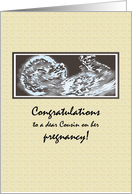 Congratulations Cousin Expecting Baby Scan card
