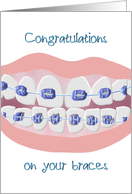Congratulations On Your Braces Braces And A Big Smile card