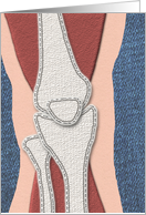 Knee Replacement Get Well Card - Fabric Collage Knee card