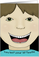 Missing Tooth- Face-You Lost Your 1st Tooth card