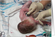 Nurses Day (Obstetrics): new baby exam card