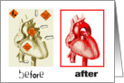 Heart Surgery - Encouragement card