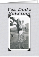 Bald Too - FUNNY card