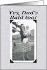 Bald Too - FUNNY card