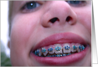 You're New Braces!