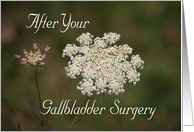 Gallbladder Surgery,...