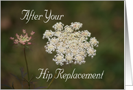 Hip Replacement,...