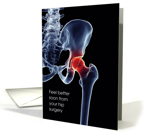 Feel Better, Hip Surgery, X-ray, Bones card (1369684)