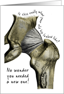 Get Well / Hip Replacement card