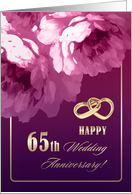 Happy 65th Wedding...