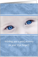 Wishing You A Quick Recovery On Your Eye Surgery Pretty Blue Eyes card