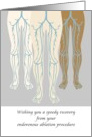 Get Well Endovenous Ablation Procedure Veins In The Legs card