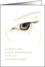 Get Well Retinal Tear Surgery Eye And Partial Profile Of Female Face card