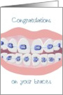 Congratulations On Your Braces Braces And A Big Smile card