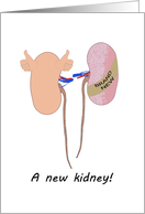 Get Well Brand New Kidney card
