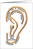 Get Well Ear Keloid Removal Surgery Outline Of The Ear card