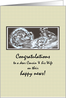 Congratulations Cousin and Wife Expecting Baby Scan card