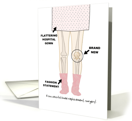 Left Knee Replacement Surgery Patient with New Knee... (1692190)