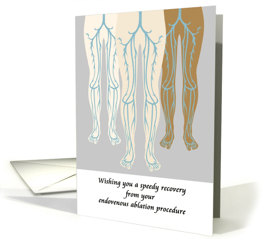 Get Well Endovenous Ablation Procedure Veins In The Legs card