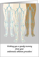 Get Well Endovenous Ablation Procedure Veins In The Legs card