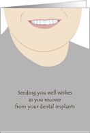 Dental Implant...