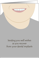 Dental Implant Surgery Get Well For Him Happy Smile Good Looking Teeth card