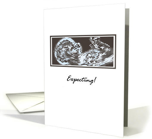 Announcing Pregnancy Illustration of Baby Ultrasound Scan card