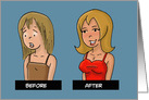 Congratulations on Your Boob Job with Before and After images card