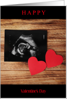 Happy Valentine’s Day Dad-To-Be with Ultrasound and Red Hearts card