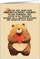 Knee Replacement...